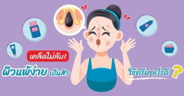 ผิวแพ้ง่าย เป็นสิว ทำยังไง