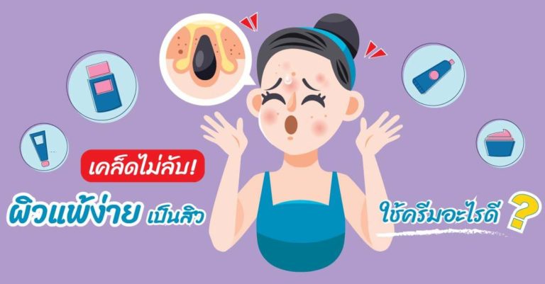 ผิวแพ้ง่าย เป็นสิว ทำยังไง
