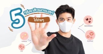 วิธีลดสิวผด จากแมสก์